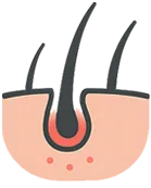 Oily Scalp / Buildup