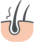 Shedding / Active Hair Loss