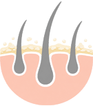Thinning Hair / Low Density