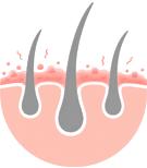 Hormonal / DHT Hair Loss