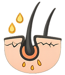 Breakage / Weak / Damaged Hair