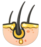 Stress / Internal Imbalance